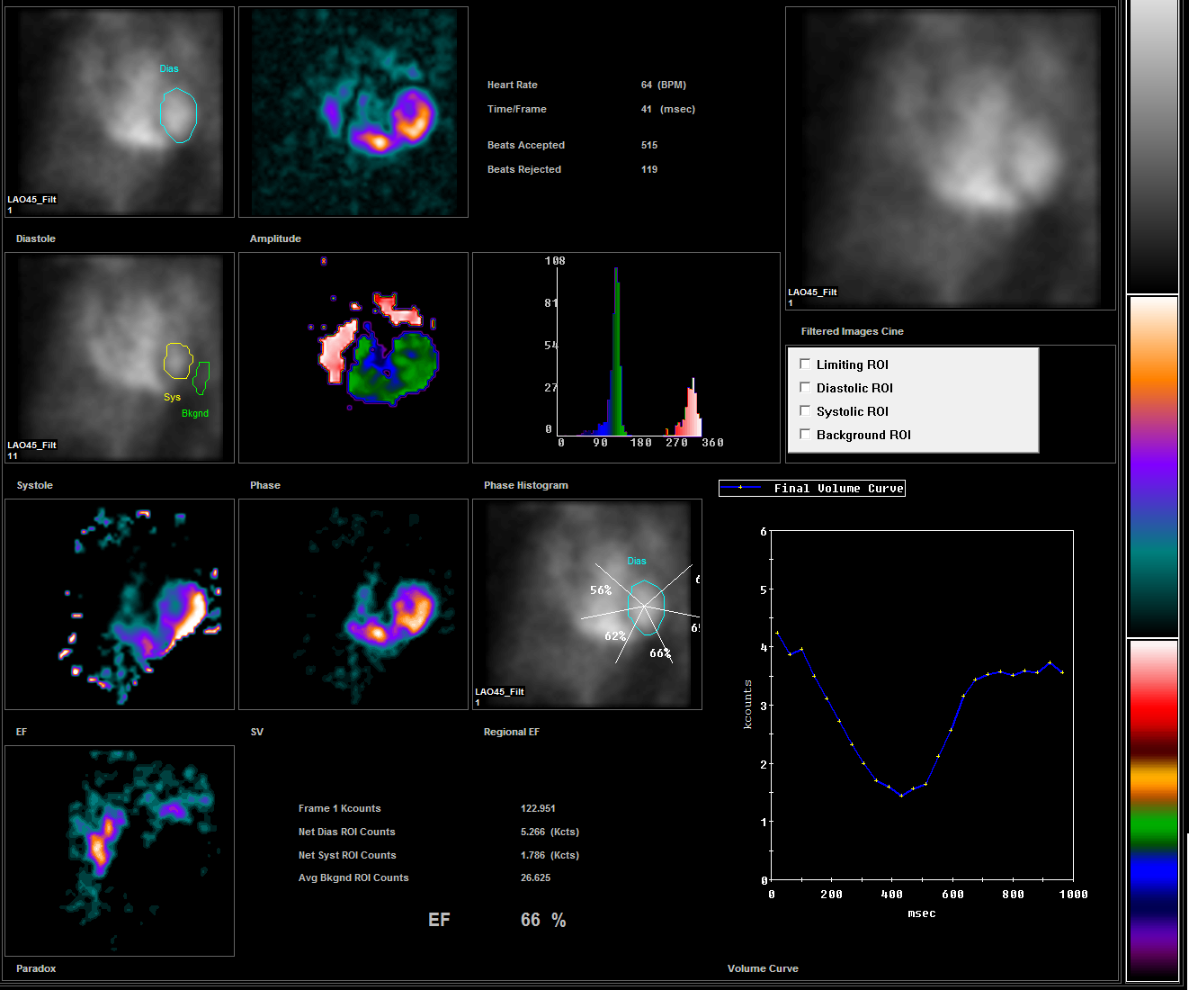 MUGA Scan (Cardiac Function)